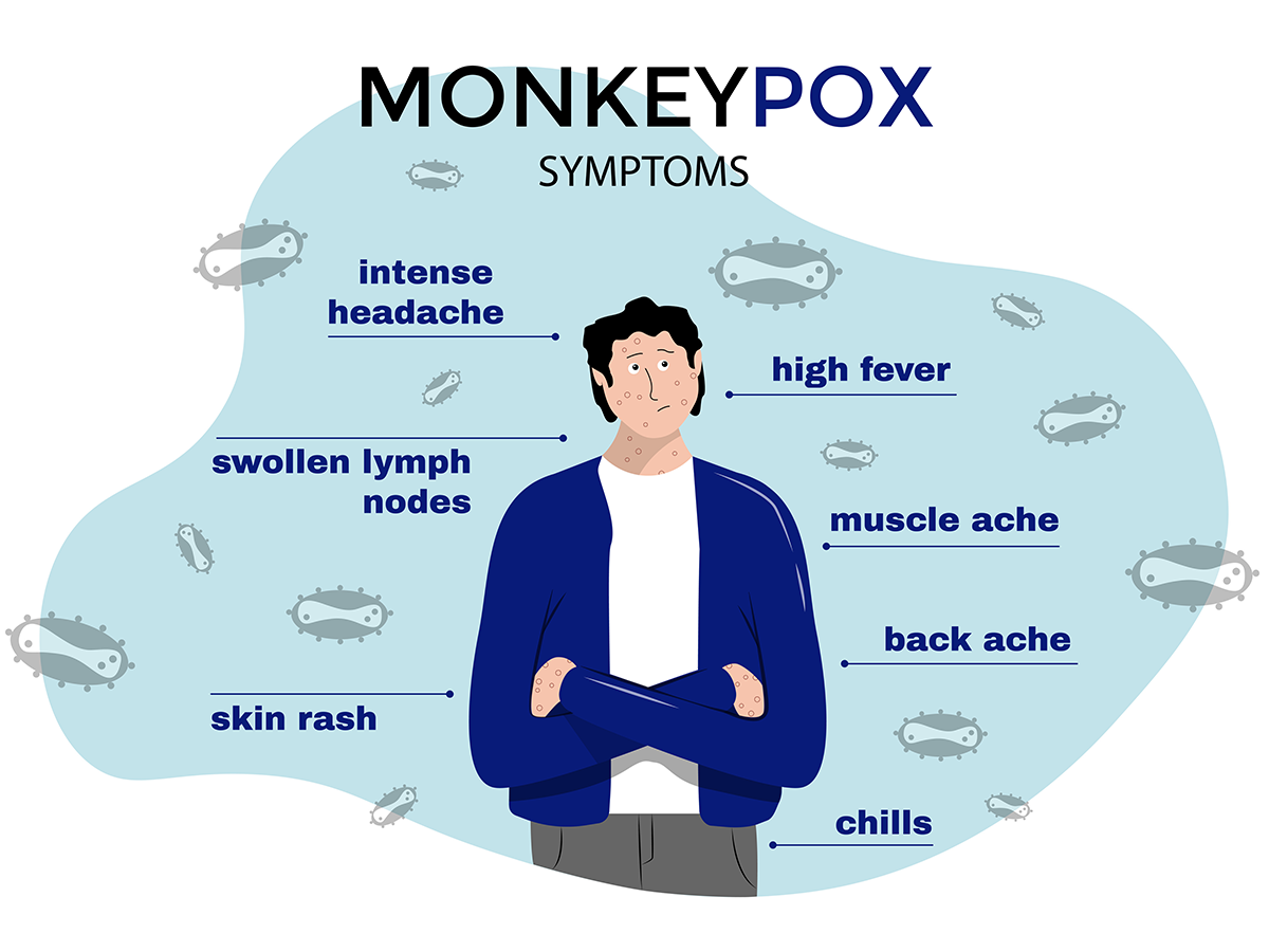 Monkeypox Updates, Texoma Medical Center, Denison, TX